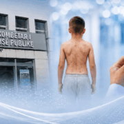 Dizajn editorial për rritjen e rasteve të fruthit në Kosovë