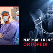 Ekipi i QKUK-së dhe dizajn editorial për ndërhyrjen e avancuar të pelvikut
