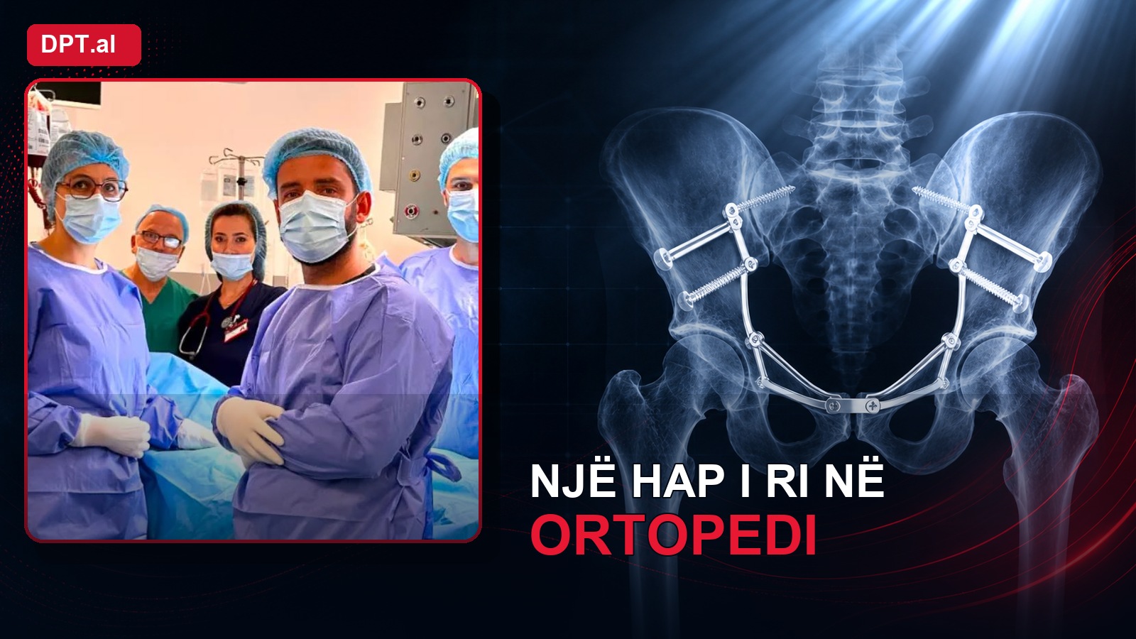 “Një hap i ri në ortopedi” – QKUK realizon ndërhyrjen e avancuar për frakturën e rëndë të pelvikut